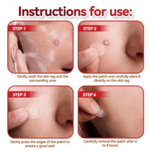 CZTICLE® 💧Microneedles Botanical Skin Tags Solution Patches - Made in the USA👩‍⚕️