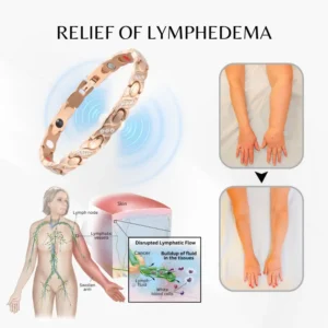 Czticle® MagnaCalm Copper Magnet Wellness Bracelet for Women