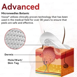 CZTICLE® 💧Microneedles Botanical Skin Tags Solution Patches - Made in the USA👩⚕️