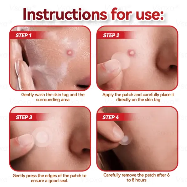 CZTICLE® 💧Microneedles Botanical Skin Tags Solution Patches - Made in the USA👩⚕️