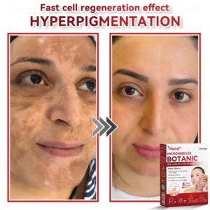 CZTICLE® 💧Microneedles Botanical Skin Tags Solution Patches - Made in the USA👩⚕️