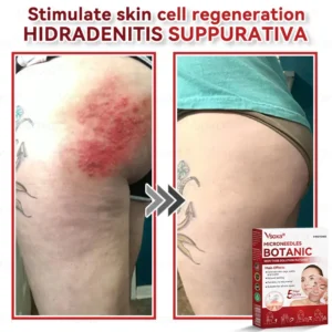CZTICLE® 💧Microneedles Botanical Skin Tags Solution Patches - Made in the USA👩⚕️